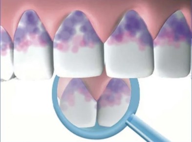 ������ ���� ��� ���������: ��� ���������� �������� �������� ������� ������� ���