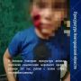 Прокуратура Великого Новгорода по информации в сети Интернет и обращению законного представителя, действующего в интересах несовершеннолетней девочки, провела проверку соблюдения законодательства в сфере ответственного...